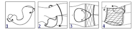 Pose de l'Amd Form