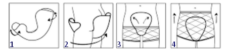 Pose de l'Amd Form