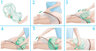 Pose du Moliform