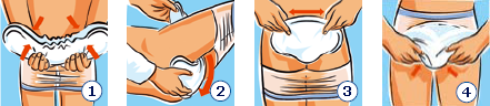 Pose du Tena Comfort debout